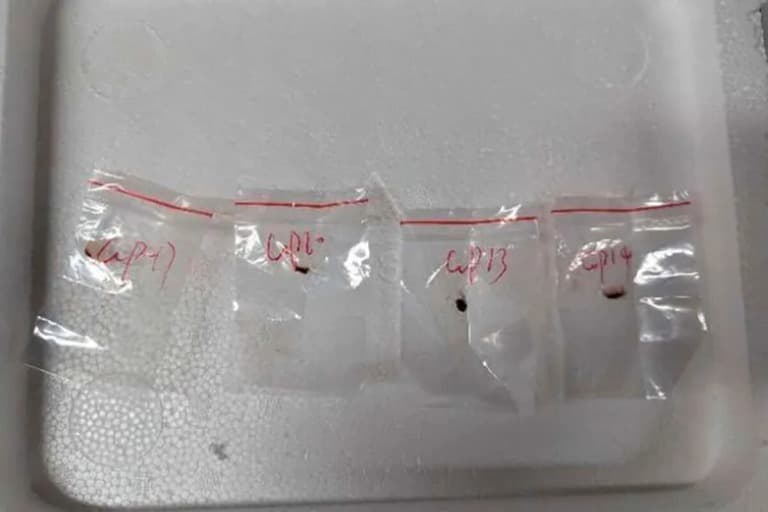 アメリカで中国人研究者２人がきけんな菌を持ちこもうとしてつかまる