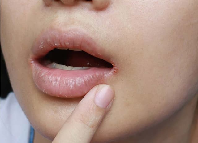 くちびるをかわかないようにするほうほう