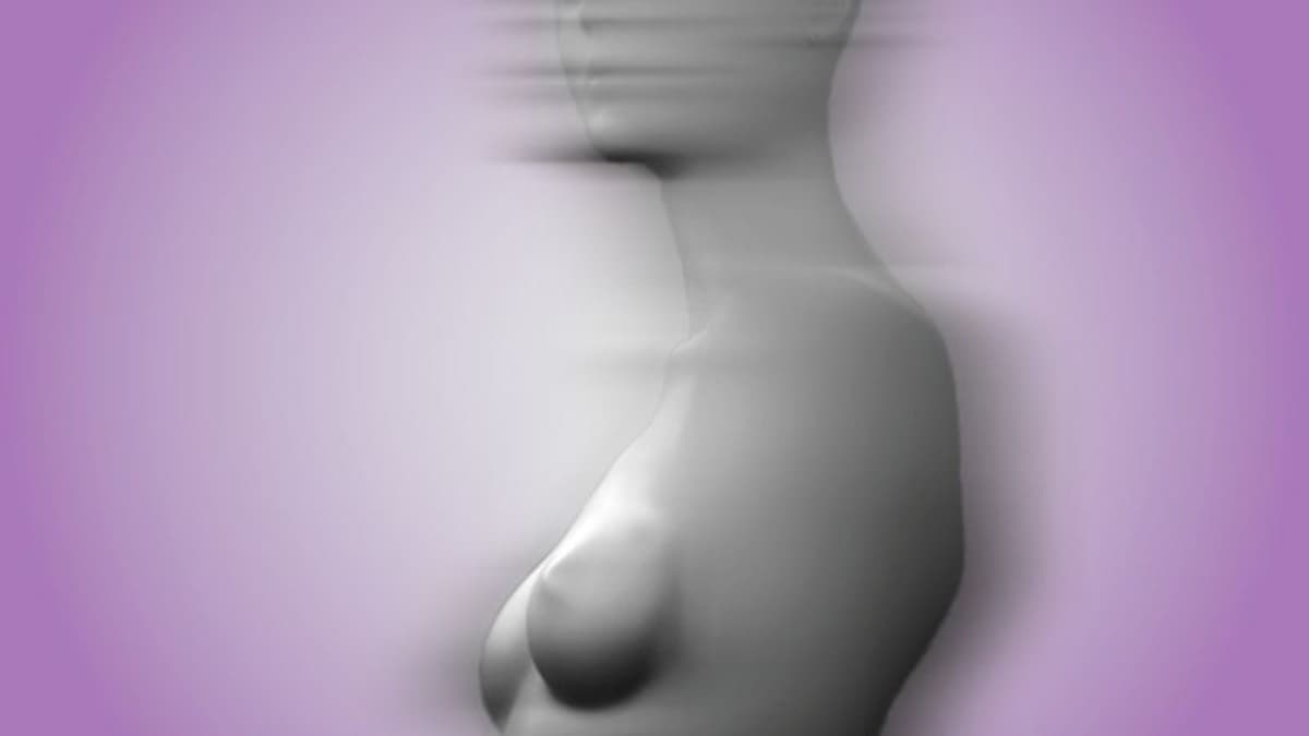 世界で増える豊胸インプラントの除去手術、その理由