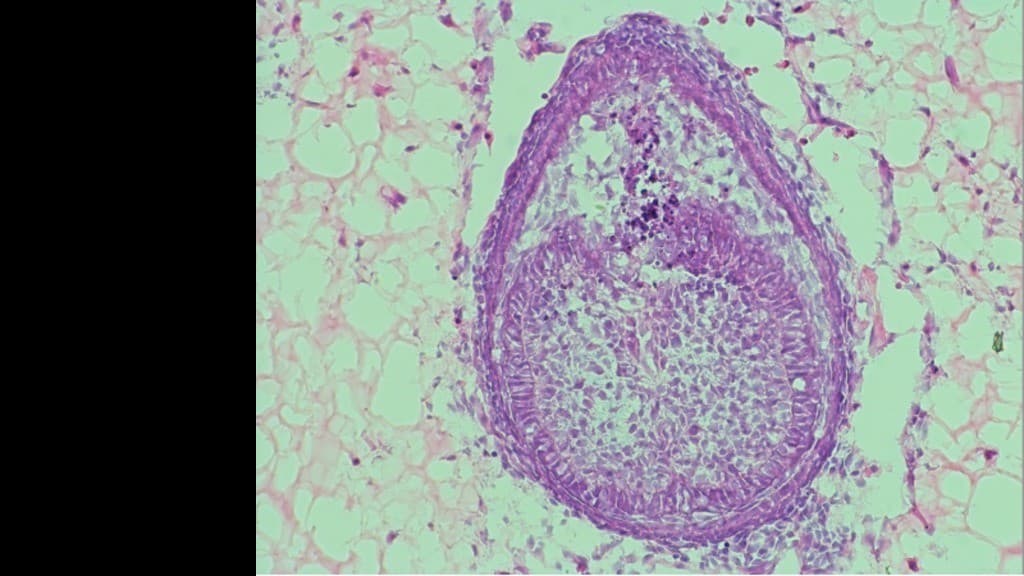 人の歯を作る研究が進んでいます