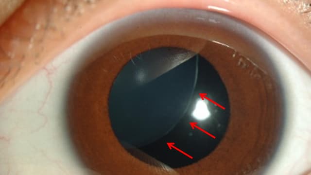 <ruby ><rb><span class="unknown" word="水晶">水晶</span><span class="jlpt-n5" word="体">体</span></rb><rt>すいしょうたい</rt></ruby><span class="" word="の">の</span><span class="" word="し">し</span><span class="" word="ご">ご</span><span class="" word="と">と</span>