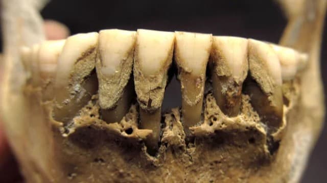 <ruby><rb><span class="jlpt-n2" word="中世">中世</span></rb><rt>ちゅうせい</rt></ruby><span class="" word="の">の</span><span class="" word="ウ">ウ</span><span class="" word="ク">ク</span><span class="" word="ラ">ラ</span><span class="" word="イ">イ</span><span class="" word="ナ">ナ</span><ruby><rb><span class="jlpt-n5" word="人">人</span></rb><rt>じん</rt></ruby><span class="" word="の">の</span><ruby><rb><span class="unknown" word="歯石">歯石</span></rb><rt>しせき</rt></ruby><span class="" word="か">か</span><span class="" word="ら">ら</span><span class="" word="キ">キ</span><span class="" word="ビ">ビ</span><span class="" word="を">を</span><ruby><rb><span class="" word="食">食</span></rb><rt>た</rt></ruby><span class="" word="べ">べ</span><span class="" word="た">た</span><span class="" word="こ">こ</span><span class="" word="と">と</span><span class="" word="が">が</span><ruby><rb><span class="" word="分">分</span></rb><rt>わ</rt></ruby><span class="" word="か">か</span><span class="" word="っ">っ</span><span class="" word="た">た</span>