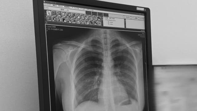 <span class="" word="2">2</span><span class="" word="2">2</span><ruby ><rb><span class="jlpt-n1" word="歳">歳</span></rb><rt>さい</rt></ruby><span class="" word="の">の</span><span class="jlpt-n2" word="モデル">モデル</span><span class="" word="、">、</span><ruby ><rb><span class="unknown" word="豊島">豊島</span></rb><rt>とよしま</rt></ruby><ruby ><rb><span class="jlpt-n4" word="心">心</span></rb><rt>こころ</rt></ruby><span class="jlpt-n1" word="さん">さん</span><span class="" word="が">が</span><span class="" word="X">X</span><ruby ><rb><span class="jlpt-n4" word="線">線</span></rb><rt>せん</rt></ruby><ruby ><rb><span class="jlpt-n5" word="写真">写真</span></rb><rt>しゃしん</rt></ruby><span class="" word="を">を</span><span class="" word="S">S</span><span class="" word="N">N</span><span class="" word="S">S</span><span class="" word="で">で</span><ruby ><rb><span class="jlpt-n1" word="公開">公開</span></rb><rt>こうかい</rt></ruby><span class="" word="し">し</span><span class="" word="て">て</span><ruby ><rb><span class="jlpt-n3" word="話題">話題</span></rb><rt>わだい</rt></ruby><span class="" word="に">に</span>