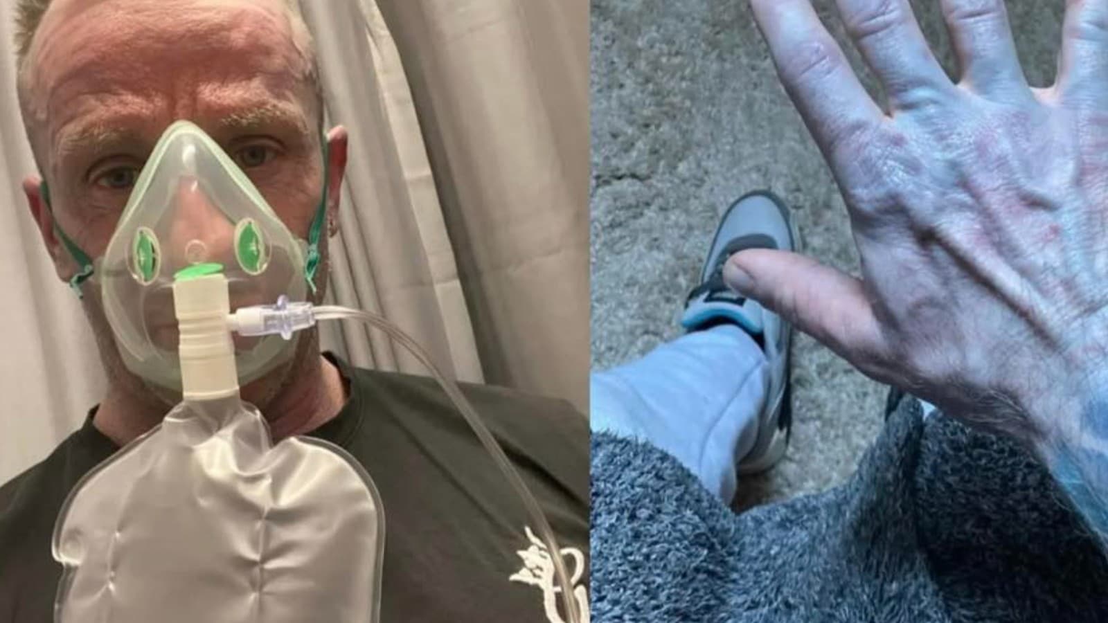 朝、体が青くなりました