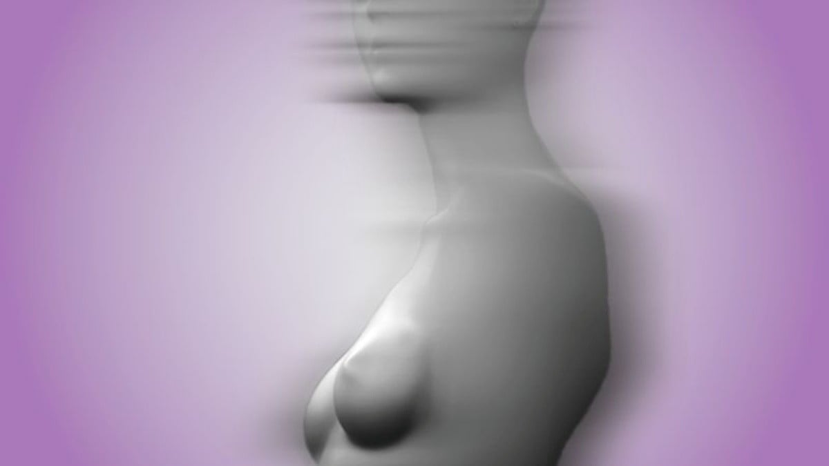 世界で増える豊胸インプラントの除去手術、その理由